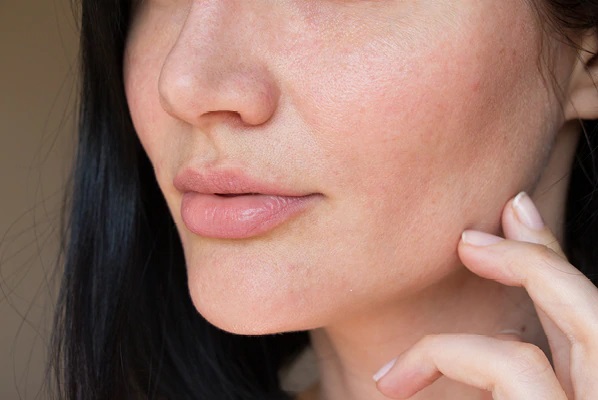 How do you treat dry skin on the face?